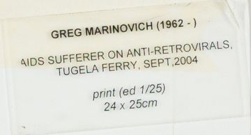 Greg Marinovich; Aids Sufferer Who is on Anti-retrovirals, Tugela Ferry, KZN